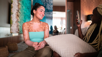 fille avec du vitiligo