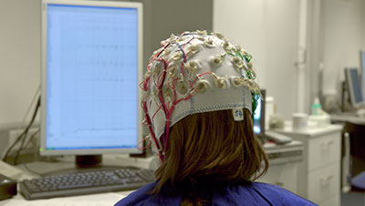 epilepsie test cerveau sur un enfant 